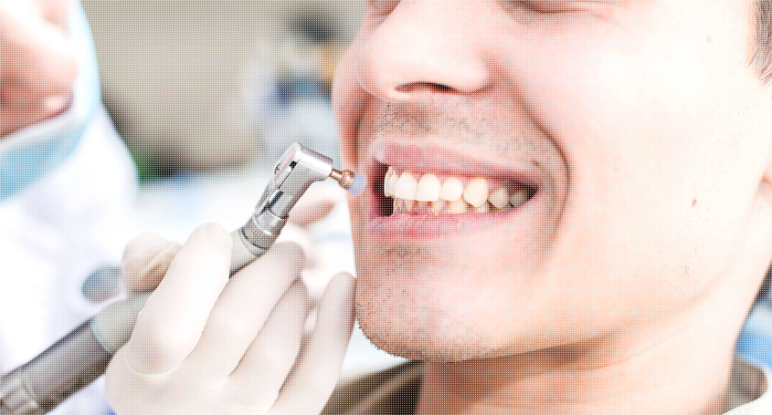 Tooth Whitening