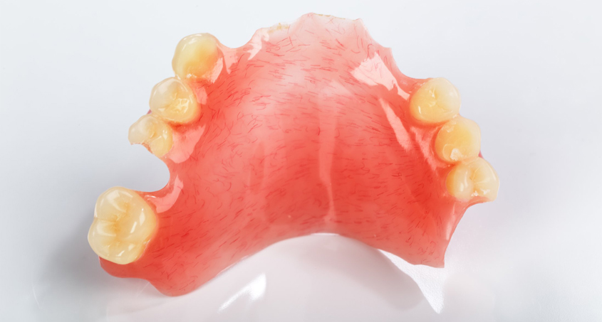 Your Dental Options: Removeable Partial Dentures